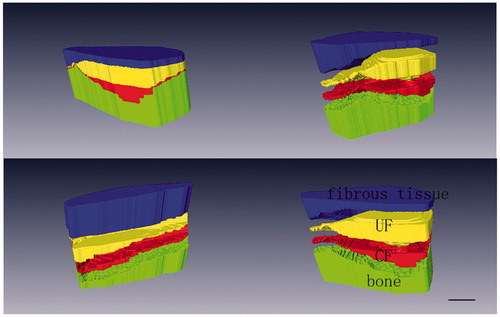 Figure 5. The three-dimensional model of ACL tibial insertions. Blue represented fibrous tissue, yellow denoted UF, red standed for CF, and green denoted bone. The junction between the CF and subchondral bone was highly irregular, with a jigsaw-like interlocking of CF pieces and bone promoting a strong union. Scale bar = 2 mm.