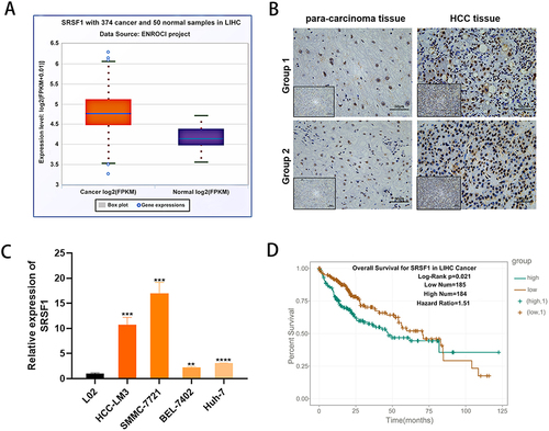 Figure 1 SRSF1 is up-regulated in HCC tissues and cell lines. (A) SRSF1 mRNA had high expression in HCC tissues compared with adjacent normal tissues. (B) SRSF1 protein had high expression in HCC tissues compared with para-carcinoma tissues. (C) SRSF1 had high expression in HCC cell lines. (D) Kaplan–Meier curves showed that high SRSF1 expression correlated with poor survival rate of patients of HCC according to TCGA database. **p < 0.01; ***p < 0.001; ****p < 0.0001.