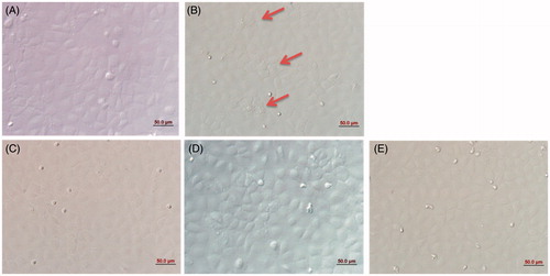 Figure 2. Morphology of IEC-6 cells. In the normal condition, the distribution of IEC-6 cells was compact and regular (A). Heat shock markedly altered IEC-6 cellular morphology; red arrows represent changes in cell shape (B). PA regulated cellular morphology and the arrangements of IEC-6 cells returned to normal. (A) control cells without any processing; (B)heat shock; (C) pretreatment with 10 ng/mL PA + heat shock; (D) pretreatment with 40 ng/mL PA + heat shock; (E) pretreatment with 80 ng/mL PA + heat shock). Scale bar: 50 μm.
