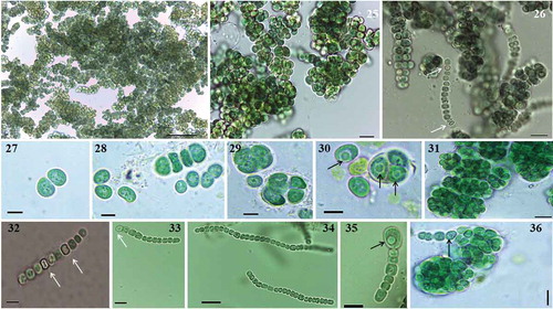 Figs 24–36. Microphotographs of Parakomarekiella sesnandensis. General characteristics of Parakomarekiella sesnandensis, showing: macroscopic colonies. Figs 24–26; equal division of akinetes. Fig. 27, forming elongated trichomes. Fig. 28; unequal division of akinetes forming spherical and encapsulated cells. Figs 29–31, 36; intercalary and terminal heterocytes. Figs 32, 33; akinete developing from a trichome. Figs 34, 35; vesicles inside the akinetes (Figs 29, 30, 34, 35, 36). Scale bar: Fig. 24, 50 µm; Fig. 25–26, 10 µm; Figs 27–30, 5 µm; Fig. 31, 10 µm; Figs 32, 33, 35, 5 µm; Figs 34, 36, 10 µm; white arrows indicate heterocysts; black arrows indicate vesicles