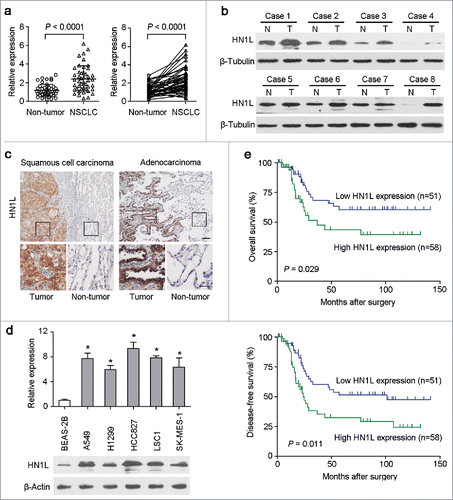 Figure 1. Overexpression of HN1L associated with poorer outcomes of NSCLCs. (a) Relative expression levels of HN1L detected by qPCR in 45 pairs of NSCLC tissues. (b) Western blot analysis of HN1L expression in matched primary tumor (T) samples and its corresponding non-tumor (N) tissues of 8 NSCLC cases. β-Tubulin was used as a loading control. (c) Representative IHC staining figures of HN1L expression in lung squamous cell carcinoma and adenocarcinoma. Scale bar, top figures, 100 μm; bottom figures, 50μm. (d) Relative expression levels of HN1L detected by qPCR and western blotting in an immortalized bronchial epithelial cell line (BEAS-2B) and other five NSCLC cell lines. Data represent mean ± SD. * P < 0.05. β-Actin was used as a loading control. (e) Kaplan-Meier analysis indicating the correlation of HN1L overexpression with poorer overall survival and disease-free survival rates of NSCLC patients.