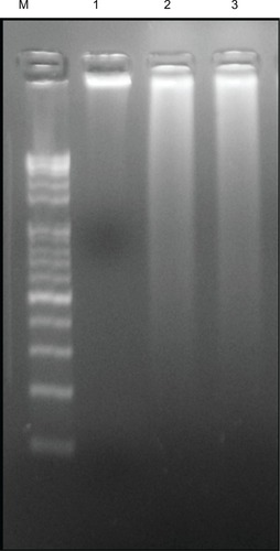 Figure 10 Effect of silver nanoparticles (AgNPs) on DNA fragmentation. MDA-MB-231 human breast cancer cells were treated with AgNPs for 24 hours, and DNA fragmentation was analyzed by agarose gel electrophoresis.Notes: Lane M, 1 kB ladder; lane 1, control; lane 2, AgNPs (6 μg/mL); lane 3, doxorubicin (1 μM).