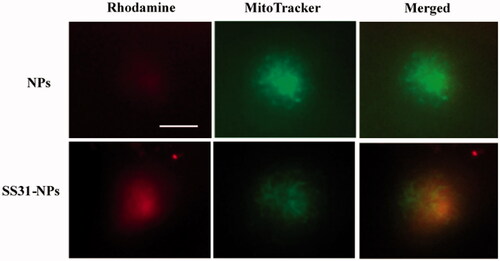 Figure 5. SS-31 modified NPs localization into the mitochondrial in hair cells. Zebrafish larvae (5 dpf) were pretreated with fluorescently-labeled NPs or SS31-NPs (1% of mPEG-PLGA was substituted) for 4 h and the hair cell mitochondria were labeled by 100 nM of Mitotracker Green for 30 min. Epifluorescent imaging showed mitochondrial staining by fluorescently-labeled SS-31 modified NPs. Scale bar: 10 μm.