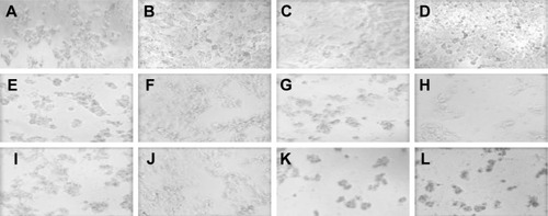Figure 5 Representative photos show MCF-7 cells after incubation for 72 hours (magnification power 20×).Notes: (A) Control of untreated cells. (B–D) Represent cells treated with 15, 40, 80 nM of empty NPs respectively. (E, G, I, K) Show cells treated with 15, 20, 40, 80 nM of free ANS respectively, while (F, H, J, L) demonstrate photos of cells treated with 15, 20, 40, 80 nM of ANS-NPs respectively.Abbreviations: ANS, anastrozole; NPs, nanoparticles.