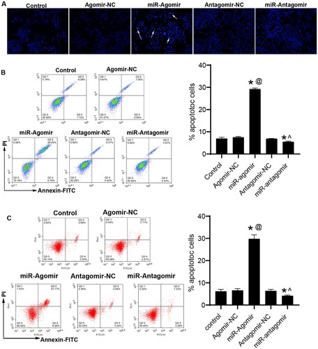 Figure 2. miR-149-3p promotes apoptosis of U-937 and HL-60 cells. (A) Hoechst 33258 staining was performed to examine the apoptosis of U-937 cells after transfection. (B) Flow cytometry was performed to detect apoptosis of U-937 cells after transfection. (C) Flow cytometry was performed to detect apoptosis of HL-60 cells after transfection. Data represents the mean ± standard deviation. * p < 0.05 vs. control; @ p < 0.05 vs. Agomir-NC; ^ p < 0.05 vs. Antagomir-NC.
