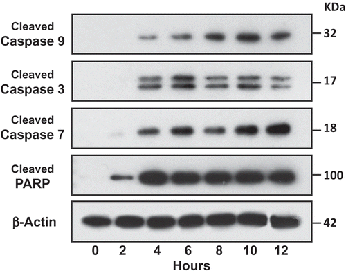 Figure 7. Activation of caspases in target cells by aNK extracellular vesicles. ALL NALM-6 cells were treated with aNK EVs for different time points as indicated. Cells were then harvested and lysed in SDS-PAGE sample buffer. Each lane contains 30 μg cell lysate proteins as determined by the Orbit® protein assay (Life Technologies). Antibodies against cleaved caspase -3, -7, and -9, and PARP from the Cleaved Caspase Antibody Sampler Kit were used to probe the blots according to the manufacturer’s protocol. β-Actin was used as the loading control. The un-cropped images with size markers are shown in Figure S5.