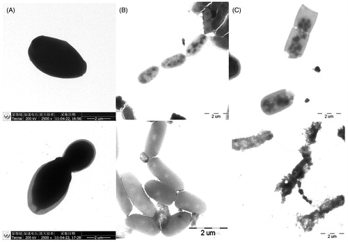 Figure 6. TEM images of Candida albicans with and without drugs. (A) The images of Candida albicans in the absence of drugs; (B) the images of C. albicans in the presence of 16 μmol L−1 ECZ (left) and 28 μmol L−1 ECZ (right); (C) the images of C. albicans in the presence of 12 μmol L−1 MIZ (left) and 28 μmol L−1 MIZ (right).