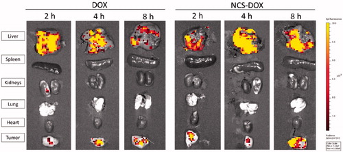 Figure 1. Ex vivo fluorescence of Doxorubicin in organs collected from mice treated with free doxorubicin (DOX) or with nanocapsules containing selol and doxorubicin (NCS-DOX) at 2, 4 and 8 h post-administration. Each panel above shows the organs of one representative animal out of three studied for each time and treatment.