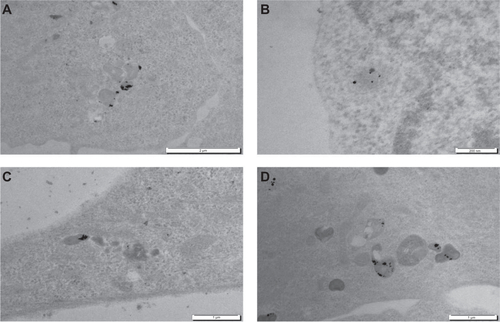 Figure S1 Cellular uptake of gold nanoparticles of different sizes in pure deionized water. Transmission electron microscopy images of neuroblastoma cells incubated with 1 mg/L gold nanoparticles in pure deionized water of 6 nm (A), 12 nm (B), or 19 nm (C) or polydispersed (D) for 24 hours.