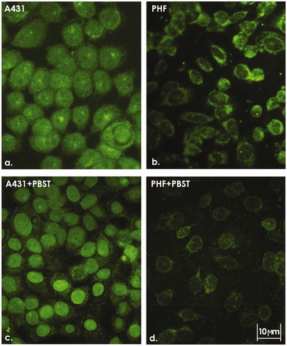 Figure 1. ICC staining of A431 cells and PHF normal fibroblasts. Intracellular localization of VEGFR-1 in (a) A431 and (b) PHF cells. (c) Nuclear localization of VEGFR-1 in A431 cells treated with 0.05% PBST prior to fixation. (d) Almost complete absence of nuclear VEGFR-1 in PHF cells treated with 0.05% PBST prior to fixation. Representative images are shown. 400X magnification.
