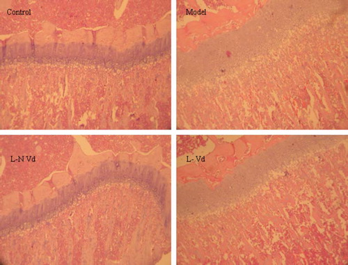 Figure 4. Histological changes in femur (HE staining, ×400).