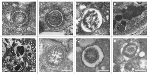 Figure 11. Electron microscopy images of autophagic structures in wild-type and autophagy mutants. (A–D) The 3 main autophagic structures (subcompartments): (A) phagophore; (B) autophagosome; (C) light-type, actively digesting autolysosome; (D) autolysosomes with dark undigested content—they may frequently have irregular shapes. (E) Complex myelinated autophagic structure in a hypodermal cell of an unc-51(e361) mutant. (F–H) Three types of secretory vacuoles, which are similar to autolysosomes. Scale bars: 500 nm.