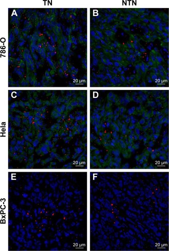 Figure 9 Binding ability of nanobubbles in xenograft tumor tissues.Notes: (A, B) The binding ability of nanobubbles to tumor cells in 786-O xenograft tumor tissues, (C, D) in Hela xenograft tumor tissues, and (E, F) in BxPC-3 xenograft tumor tissues. Blue fluorescence indicates cell nuclei, green fluorescence indicates the cell membranes of CAIX-positive cells, and red fluorescence indicates nanobubbles.Abbreviations: TN, targeted nanobubbles; NTN, non-targeted nanobubbles; CAIX, carbonic anhydrase IX.