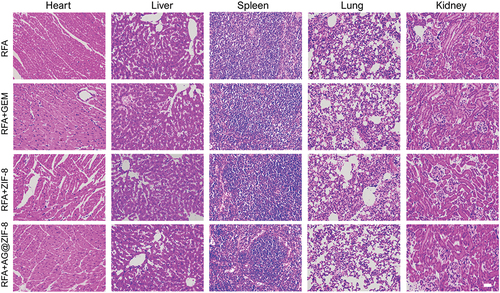 Figure 10. After treatment with different formulations, HE stains images of tissue in the mice’s organs (heart, liver, spleen, lung, and kidney). Scale bar=100 µm.
