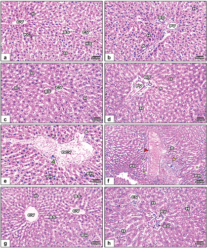 Figure 6. Images of histological sections of liver among the different studied groups of rats (images a&b: control, images c&d: GE, images e&f: LPS, and images g&f LPS+GE). The liver sections in images e&f show a dilated central vein with a degenerated endothelium (white arrowhead), infiltrated cells (green arrowhead), scattered pyknotic hepatocytes (PH), dilated blood sinusoids (yellow stars), a thickened wall of the hepatic portal vein (red arrowheads), and a profibrotic portal area (yellow arrowheads). (stain: Hx&E, scale bar: 100).