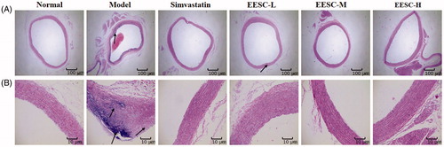 Figure 2. Effect of EESC on histopathological changes in rat aorta (H&E staining). (A) magnification ×40, bar: 100 μm; (B) magnification ×200, bar: 10 μm. Arrows indicate pathological changes.