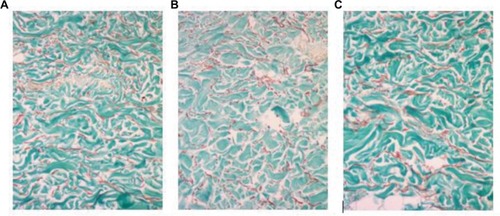 Figure 3 Masson–Goldner staining of dermal tissue in the ex vivo photoaging study, with connective fibers stained blue-green, fibroblast nuclei stained dark brown-black, and fibroblast cytoplasm stained light red-pink (magnification 200×).Notes: (A) Untreated control tissue; (B) irradiated control tissue; and (C) irradiated and serum-treated tissue.