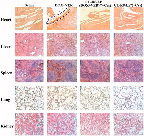Figure 8. Histological analysis for different organs of MCF-7/ADR tumor bearing mice after treatment. (All tissues: 200×). The analysis showed that DOX + VER resulted in heart toxicity as indicated by the appearance of hyperemia, myocardial fiber breakage and necrosis with acute inflammatory cell infiltration (delineated with the dotted line). In contrast, mice administrated with saline, drug loaded or blank liposomes did not exhibit obvious signs of toxicity.