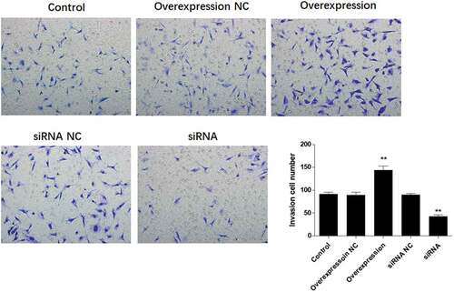 Figure 5. ATF3 promotes the invasive potential of keloid fibroblast cells