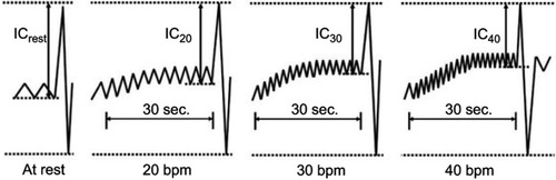 Figure 2 Details of dynamic lung hyperinflation measurement method using spirometer.Abbreviations: IC, inspiratory capacity; bpm, breaths/min; ICrest, IC at rest; IC20, IC at 20 bpm; IC30, IC at 30 bpm; IC40, IC at 40 bpm.