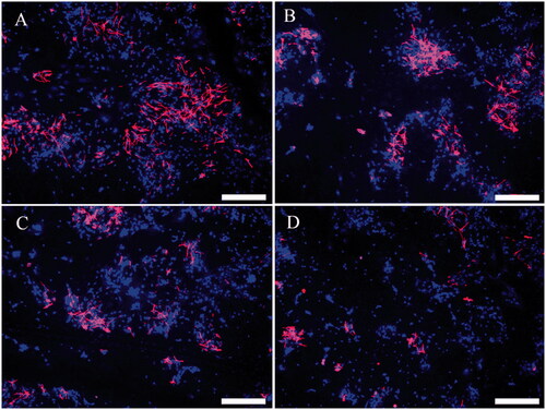 Figure 8. Immunofluorescence of NSC differentiation into astrocytes. Differentiated astrocytes in the PLGA group (A), PLGA/GO group (B), PLGA + ES group (C), and PLGA/GO + ES group (D). Immunostaining markers are GFAP (red) for neurons and DAPI (blue) for nuclei. The scale bar was 200 μ.