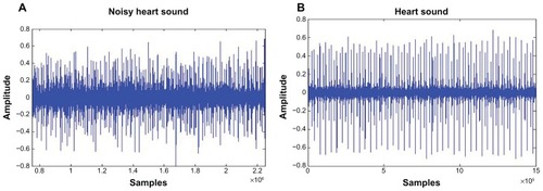 Figure 3 (A and B) Average signal of normal patient. (A) Noisy heart signal; (B) clean heart signal.