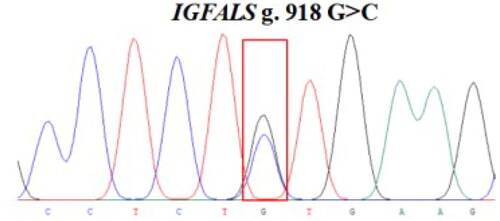 Figure 3. Image of the sequencing peaks of sheep IGFALS g.918 G > C loci.