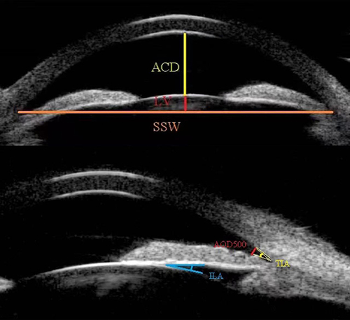 Figure 1 Standardised collection of quantitative parameters of ocular UBM images.