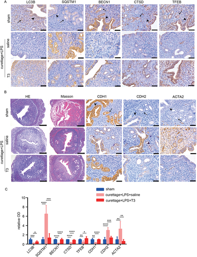 Figure 8. T3 improves autophagy and attenuates endometrial fibrosis in vivo. The mice were divided into the following three groups: sham operation, curettage+LPS+saline and curettage+LPS+T3 (40 mg/kg). (A) Immunohistochemical staining of LC3B, SQSTM1, BECN1, CTSD and TFEB in endometria of mice with sham-operation (sham, n = 4), dual-damage IUA-like mice model (curettage+LPS+saline, n = 4) and IUA with T3 treatment (curettage+LPS+T3, n = 4). Scale bars: 50 μm. (B) HE, Masson staining (scale bars of HE and Masson: 250 μm) and immunohistochemical staining of CDH1, CDH2 and ACTA2 in endometria of mice. Scale bars: 50 μm. (C) Relative optical densities (OD) analyzed by Image-pro plus. Arrow head: luminal epithelial cells; arrow: glandular epithelial cells. Error bars, mean ± SEM. *P < 0.05, **P < 0.01, ***P < 0.001, ****P < 0.0001.