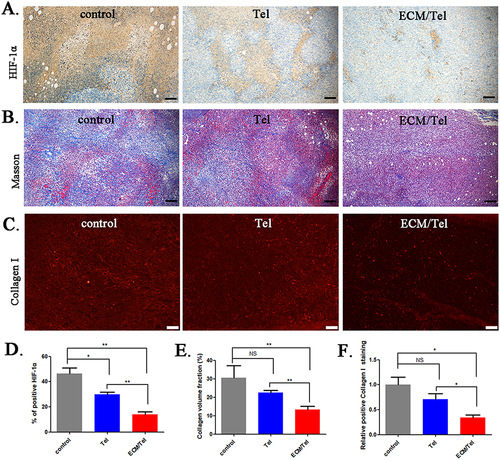 Figure 4 Changes in the tumor microenvironment of mice treated with ECM/Tel. (A) Immunohistochemical staining for HIF-1α. (B) Masson staining. Scale bar: 100 μm. (C) Collagen I immunofluorescent staining. Scale bar: 50 μm. (D) Semi-quantitative analysis of HIF-1α. (E) Semi-quantitative determination of Masson’s staining. (F) Semi-quantitative assay of Collagen immunofluorescence staining. NS: no significant difference, *P < 0.05, **P < 0.01.