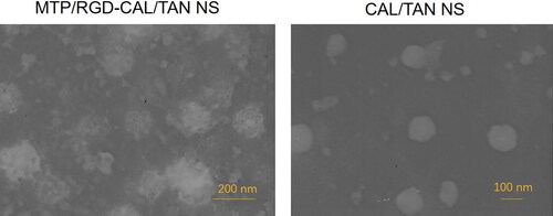 Figure 3. The TEM images of MTP/RGD-CAL/TAN NS and CAL/TAN NS.