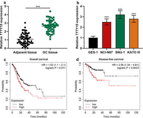 Figure 1. The expression characteristics of TTTY15 in GC. (a) TTTY15 expression in GC tissues and para-tumorous tissues was detected by qRT-PCR. (b) TTTY15 expression in GC cell lines (NCI-N87, SNU-1 and KATO III) and GES-1 cells was detected by qRT-PCR. (c and d) Kaplan-Meier Plotter database was applied for analyzing the association between TTTY15 expression and the GC patient’s survival time. All of the experiments were performed in triplicate. *** P < 0.001.