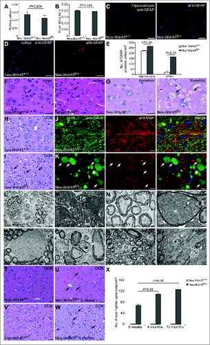 Figure 2. Nes-Wdr45fl/Ymice show axon swelling. (A) The number of Purkinje cells was quantified and divided by the total length of the lobules III, IV and V. (B) The number of CA1 hippocampal pyramidal cells of Nes-Wdr45+/Y and Nes-Wdr45fl/Y mice at 13 mo was quantified and divided by the length of the layer. Mean ± SEM of 3 mice is shown (A and B). (C–E) Compared to control mice, the GFAP signals (red) in sections of hippocampus (C) and cortex (D) are stronger in Nes-Wdr45fl/Y mice. Quantification data are shown as mean±SEM of 3 mice (E). Bar: 50µm. (F) H&E staining reveals the presence of eosinophilic spheroids (arrow) in the cortex. (G) H&E staining shows vacuolated structures (arrows) in thalamus. (H and I) H&E staining reveals the presence of eosinophilic spheroids (arrows) in the DCN of Nes-Wdr45fl/Y mice at 13 mo. Bar: 20 µm (F–I). (J and K) Costaining of CALB (green) and MBP (red) shows that Nes-Wdr45fl/Y mice at 13 mo exhibit dilated CALB-positive bulbs (arrows) in the DCN region. Bar: 10 µm. (L to Q) EM pictures of DCN in Nes-Wdr45+/Y (L and N) and Nes-Wdr45fl/Y (M, O, P and Q) mice at 13 mo. Arrows in (M) indicate swollen axons. Swollen mitochondria accumulate in these axons (arrows in O).The arrow in (P) indicates a demyelinated axon. Degenerated axons were also occasionally detected (Q). Bar: 2 µm (L and M), 500 nm (N–Q). (R and S) EM pictures of medulla in Nes-Wdr45+/Y (R) and Nes-Wdr45fl/Y (S) mice at 13 mo. Arrows in (S) indicate degenerated axons. Bar: 500 nm. (T–X) H&E staining of the DCN from Wdr45 mutant mice and controls at 6 wk and 4 mo. Arrows indicate eosinophilic spheroids. Quantification data are shown as mean±SEM of 3 mice (X). Bar: 20µm.