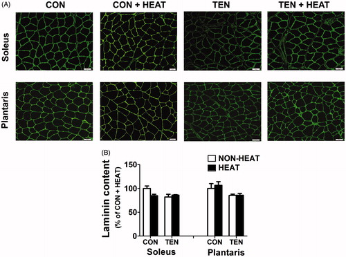 Figure 7. Effects of heat stress and tenotomy on laminin content in soleus and plantrais muscles. (A) Immunofluorescence staining of laminin of control (CON), control combined with heat stress (CON+HEAT), tenotomy (TEN), and tenotomy combined with heat stress (TEN+HEAT). Scale bars = 50 µm. (B) Fluorescence intensity of laminin (n = 3–4 rats/group).