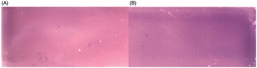 Figure 3. Comparison of bioautographic thin layer chromatograms obtained for Mycobacterium tuberculosis H37Ra phosphoglucose isomerase (Myc. tbc H37Ra PGI) with the use of staining solutions containing different coenzymes of the auxiliary enzyme Leuconostoc mesenteroides glucose-6-phosphate dehydrogenase. A – reaction with NAD+; B – reaction with NADP+. The experiments were performed with 15 U of Myc. tbc H37Ra PGI activity. Staining was performed in darkness for 5 min at room temperature.