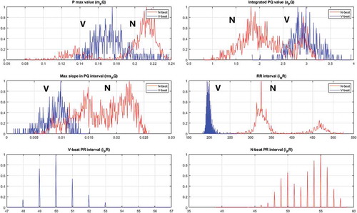 Figure 7. A histogram of the five features when the MIT-BIH set 119 is processed.