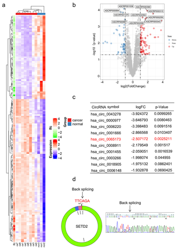 Figure 1. circSETD2 was downregulated in BC. (a-b) Heatmap and volcano map from the GEO microarray database (GSE101123) revealed the differentially expressed circRnas in BC and normal subjects (P value < 0.05 and log2-fold change > 1). (c) the top ten downregulated circRnas in GSE101123 are shown. (d) the diagram shows that circSETD2 is generated from exons 2–5 of the SETD2 gene. The back-splicing sites were validated by Sanger sequencing.