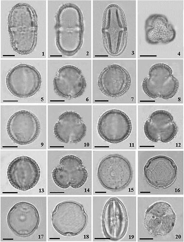 Plate 1. Optical microscopy photographs of pollen grains of Madeira endemic species. 1,2. Melanoselinum decipiens: 1. equatorial view, 2. endoaperture lalongate. 3,4. Monizia edulis: 3. equatorial view, 4. polar view; 5,6. Sinapidendron angustifolium. 5. equatorial view, 6. polar view; 7,8. Sinapidendron frutescens. 7. equatorial view, 8. polar view. 9,10. Sinapidendron gymnocalyx. 9. equatorial view, 10. polar view. 11,12. Sinapidendron rupestre. 11. equatorial view, 12. polar view. 13,14. Sinapidendron sempervivifolium. 13. equatorial view, 14. polar view. 15,16. Musschia aurea. 15. equatorial view, 16. polar view. 17,18. Musschia wollastonii. 17. equatorial view, 18. polar view. 19,20. Chamaemeles coriacea. 19. equatorial view, 20. polar view. Scale bars: 10 µm.