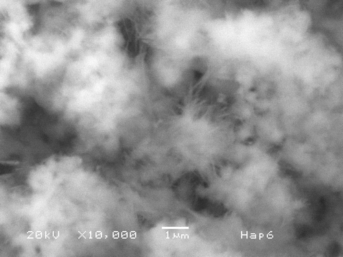 Figure 1. SEM micrograph of sample prepared as described in the text at pH = 6. Hap needles about 1 µm long and 0.1 µm thick form bundles from a common origin. These bundles join one another and fill the space (marker = 1 µm).