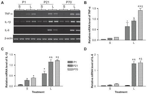 Figure 4 Relative mRNA expression of proinflammatory cytokines in the lung of P1, P21, and P70 animals. P1, P21, and P70 animals were treated with saline (s) or 0.25 mg/kg lipopolysaccharide (L) for 2 hours. Relative mRNA levels of TNF-α (A and B), IL-1β (A and C), and IL-6 (A and D) in the lung of these animals were measured by semiquantitative reverse transcription PCR.