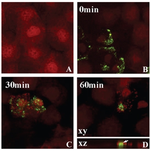 Figure 3 Lipid raft expression in the rabbit corneal epithelium. After 24 hours of PMMA lens wear, whole mount tissue was labeled with beta cholera toxin (green) and counterstained with PI (red) to label epithelial nuclei and allow for visualization of PA. (A) Undisturbed corneal epithelium. No lipid raft expression was seen in the absence of a contact lens. (B) After 24 hours of lens wear, pre-infection with PA, lipid rafts were detected in surface epithelial cells, evident by green punctate staining. (C)Thirty minutes after infection with PA, PA were seen to preferentially adhere to lipid raft expressing cells. (D) At 1 hour post infection, PA appeared to cluster around the lipid raft fraction of the plasma membrane. In the vertical XZ plane, lipid rafts appeared to associate directly with the lipid raft and internalization was noted. Copyright © 2005. Image adapted with permission from CitationYamamoto N, Yamamoto N, Petroll WM, et al. 2005. Internalization of Pseudomonas aeruginosa is mediated by lipid rafts in contact lens-wearing rabbit and cultured human corneal epithelial cells. Invest Ophthalmol Vis Sci, 46:1348–55.