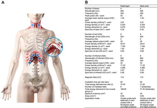 Figure 2 Irradiation of interventions. (A) shows the sites where PBMT-sMF and placebo were irradiated. The interventions were irradiated at six sites in the lower thorax/upper abdominal cavity and two sites in the neck area. (B) shows the full description of the parameters of PBMT-sMF applied in the treatment. This figure is owned by the authors.