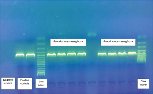 Figure 1. Agarose gel of PCR products of P. aeruginosa strains compared to positive and negative controls.