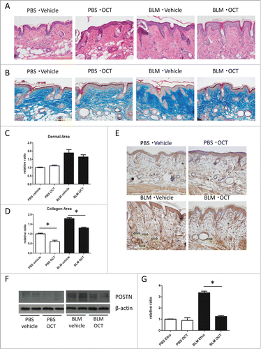Figure 3 (See previous page). OCT inhibits BLM-induced scleroderma and POSTN induction. (A) Representative H&E staining of back skin treated with PBS or BLM. Bar = 100 μm. (B) Representative Masson's trichrome staining (low magnification and high magnification) of back skin treated with PBS or BLM. Bar = 100 μm. (C) Dermal area of skin sections treated with PBS or BLM. The dermal area in each mouse was measured using Image J. Bars show the mean dermal area ± SD (N = 6). (D) Collagen area of skin sections treated with PBS of BLM. The collagen area in each mouse was measured using Olympus cellSens Dimension software. Bars show the mean dermal area ± SD (N = 6) (E) Representative POSTN staining of back skin treated with PBS of BLM. Arrows show matricellular staining of POSTN. (F) Western blot analysis of POSTN expression in mouse skin treated with either PBS or BLM. (G) Bars show the densitometric analysis of POSTN relative to the β-actin loading control. Mean ± SD of each group are shown. N = 4; *P < 0.0001, one-way ANOVA followed by the Bonferroni-Dunn test for multiple comparisons.