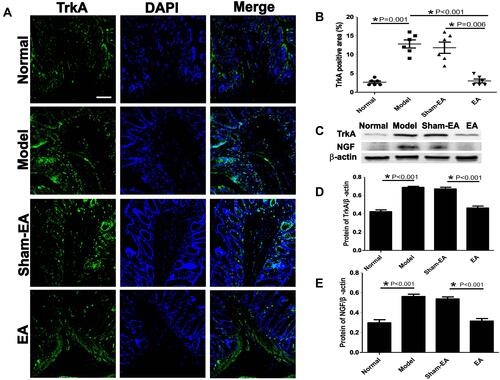 Figure 6 Expressions of NGF/TrkA proteins in the distal colon in different groups. (A) The expression of TrkA in the mucosa of each group. Scale bar=50 μm. (B) Quantitative expressions of TrkA+ area in different groups of rats. *P<0.05. (C) The expression of TrkA and NGF protein in different groups. (D and E) Quantitative expressions of TrkA and NGF proteins in different groups, respectively. *P<0.05.