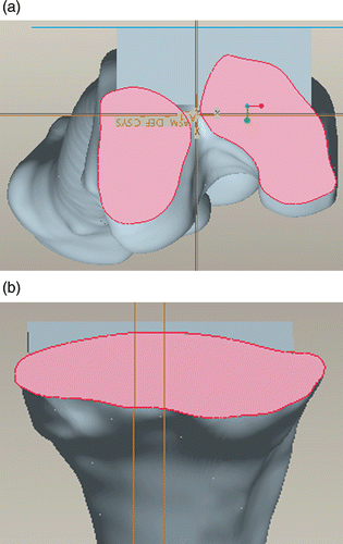 Figure 4. Surface shape after virtually cutting the distal femur and proximal tibia.