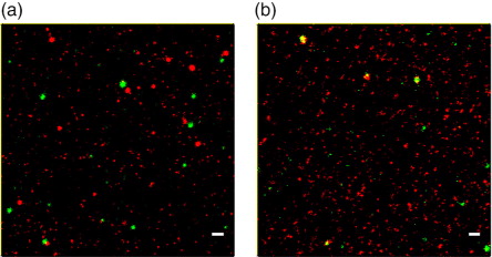 Fig. 7.  STED analysis of B cell EVs bound to anti-CD9/63/81-coated slides and stained with (a) anti-CD19-STAR488 and anti-CD9-STAR RED or (b) stained with anti-CD9-STAR488 and anti-CD42a-STAR RED. Scale bars represent 500 nm.