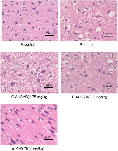 Figure 3. Effect of AHSYB on cerebral cortex pathological impairment in acute permanent cerebral ischemia rats (n = 6, Original Magnification 40).