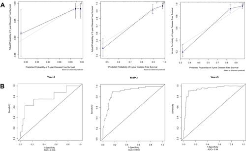 Figure 3 Calibration curve and the AUC of 1-, 3-, 5-year DFS in training cohort. (A) Calibration curve. The black dots are the scatter points on the calibration curve, representing the actual versus predicted incidence. The gray line is the reference line, that the predicted probability equals the actual probability. The two lines closely overlap, suggesting that the nomogram accurately estimated the recurrence probability of our patient cohort. (B) The AUC of 1-, 3-, 5-year DFS respectively.