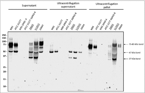 Figure 2. Association of PPAD species with OMVs Growth medium fractions (designated ‘supernatant’) of P. gingivalis sorting type I and II isolates were subject to ultracentrifugation. Subsequently, the supernatant and pellet fractions were analyzed by immunoblotting as indicated for Fig. 1. Samples relating to the reference strain W83 and ATCC 33277, the respective PPAD deletion mutants, and sorting type I and II isolates are indicated with names of type II isolates underlined. Molecular weights of marker proteins and different PPAD species are indicated.